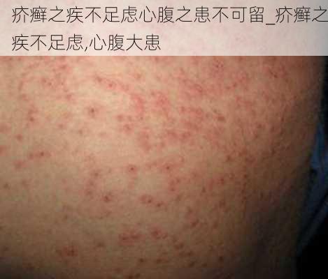 疥癣之疾不足虑心腹之患不可留_疥癣之疾不足虑,心腹大患