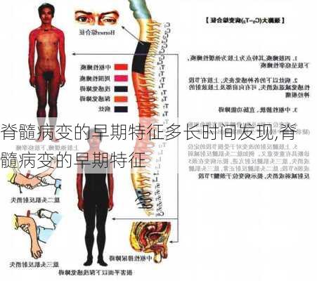 脊髓病变的早期特征多长时间发现,脊髓病变的早期特征